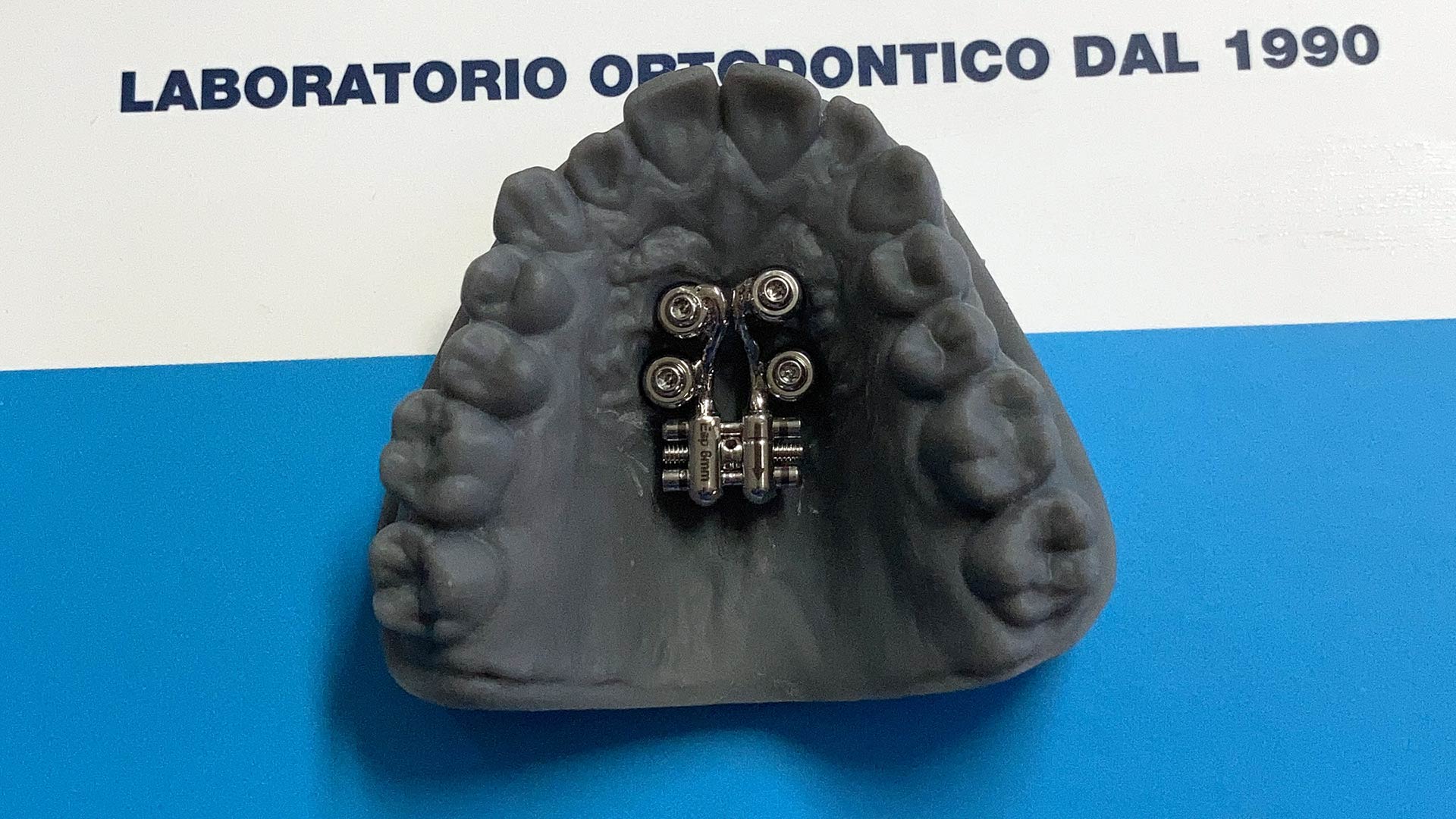 E.R.P. ad Ancoraggio Scheletrico su 4 Mini-impianti - Tecnort Ortodonzia - Laboratorio Ortodontico dal 1990 in Puglia