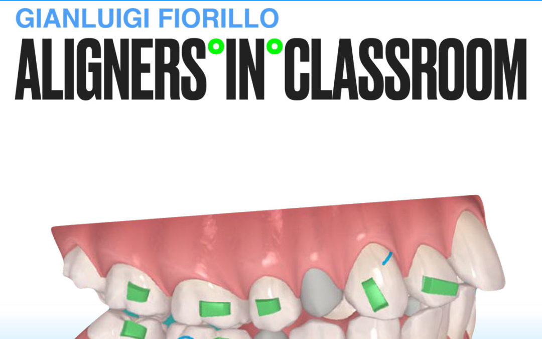 ALIGNERS IN CLASSROOM