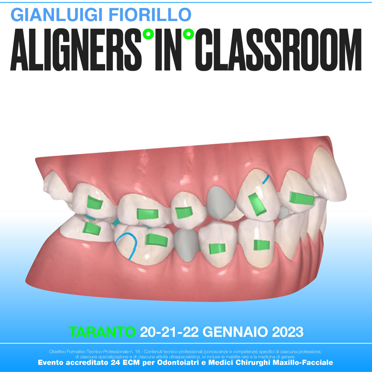 Aligners in classroom